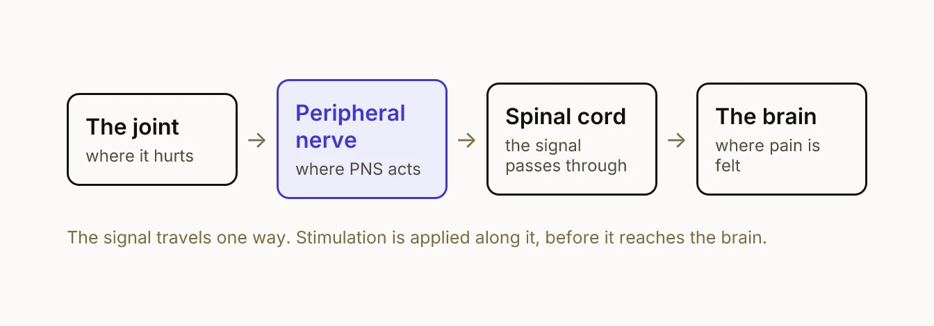 A pain signal travels from the joint along a peripheral nerve to the spinal cord and then the brain.